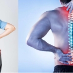 Bel Kayması Ameliyatı Nedir, Nasıl Yapılır? Adım Adım Cerrahi Süreç