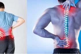 Bel Kayması Ameliyatı Nedir, Nasıl Yapılır? Adım Adım Cerrahi Süreç