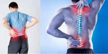 Bel Kayması Ameliyatı Nedir, Nasıl Yapılır? Adım Adım Cerrahi Süreç